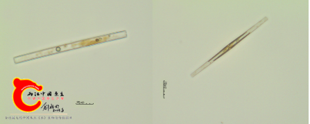 中型脆杆藻Fragilaria intermedia (2).png