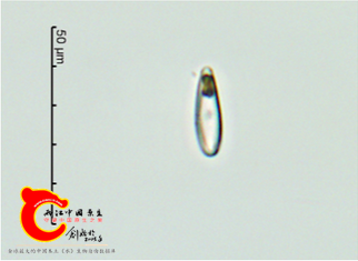缢缩异极藻头状变种Gomphonemaconstrictumvar.capitata.png