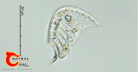 螺旋双菱藻Surirellaspiralis.png