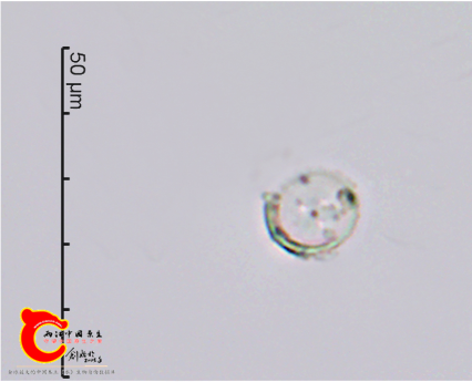 科曼小环藻Cyclotellacomensis.png