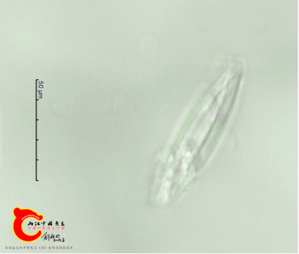 菱形肋缝藻Frustulia rhomboids.png